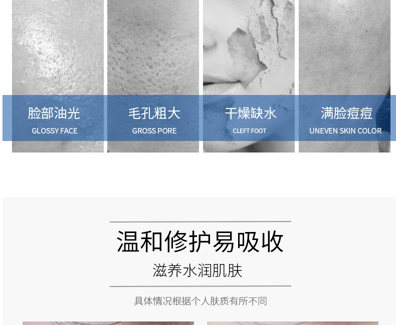 帝皇蜂黄金烟酰胺补水保湿紧致精华-广州精华原液OEM/ODM代加工