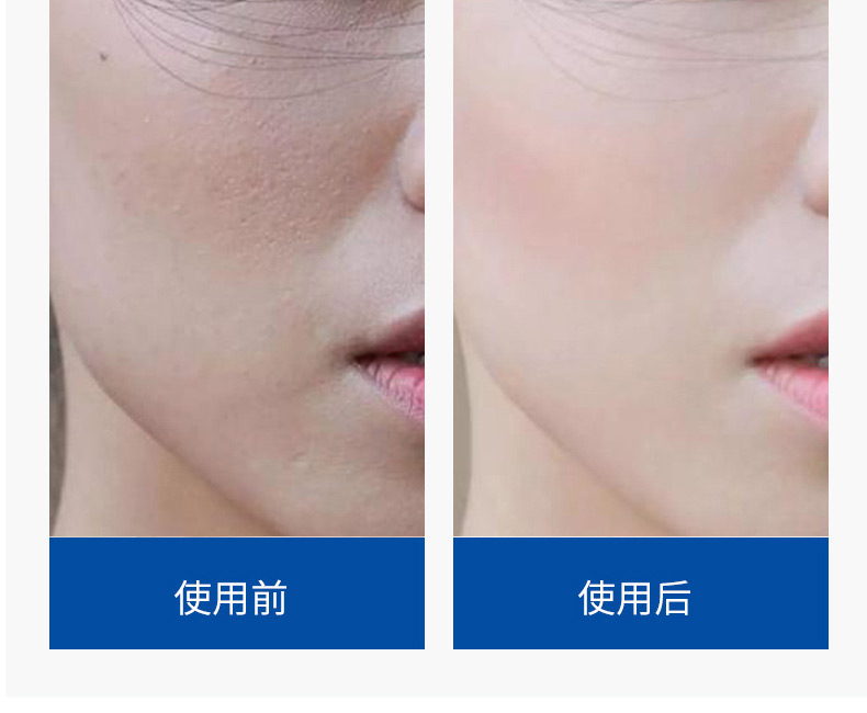 帝皇蜂黄金烟酰胺补水保湿紧致精华-广州精华原液OEM/ODM代加工